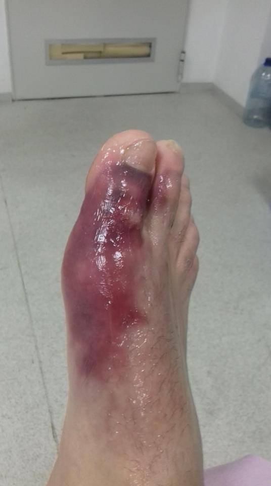 După accidentarea din meciul cu Sporting, Georgian Păun așteaptă cu sufletul la gură diagnosticul de după RMN După accidentarea din meciul cu Sporting, Georgian Păun așteaptă cu sufletul la gură diagnosticul de după RMN